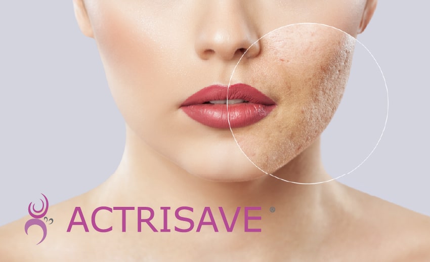 Obraz opcji produktu