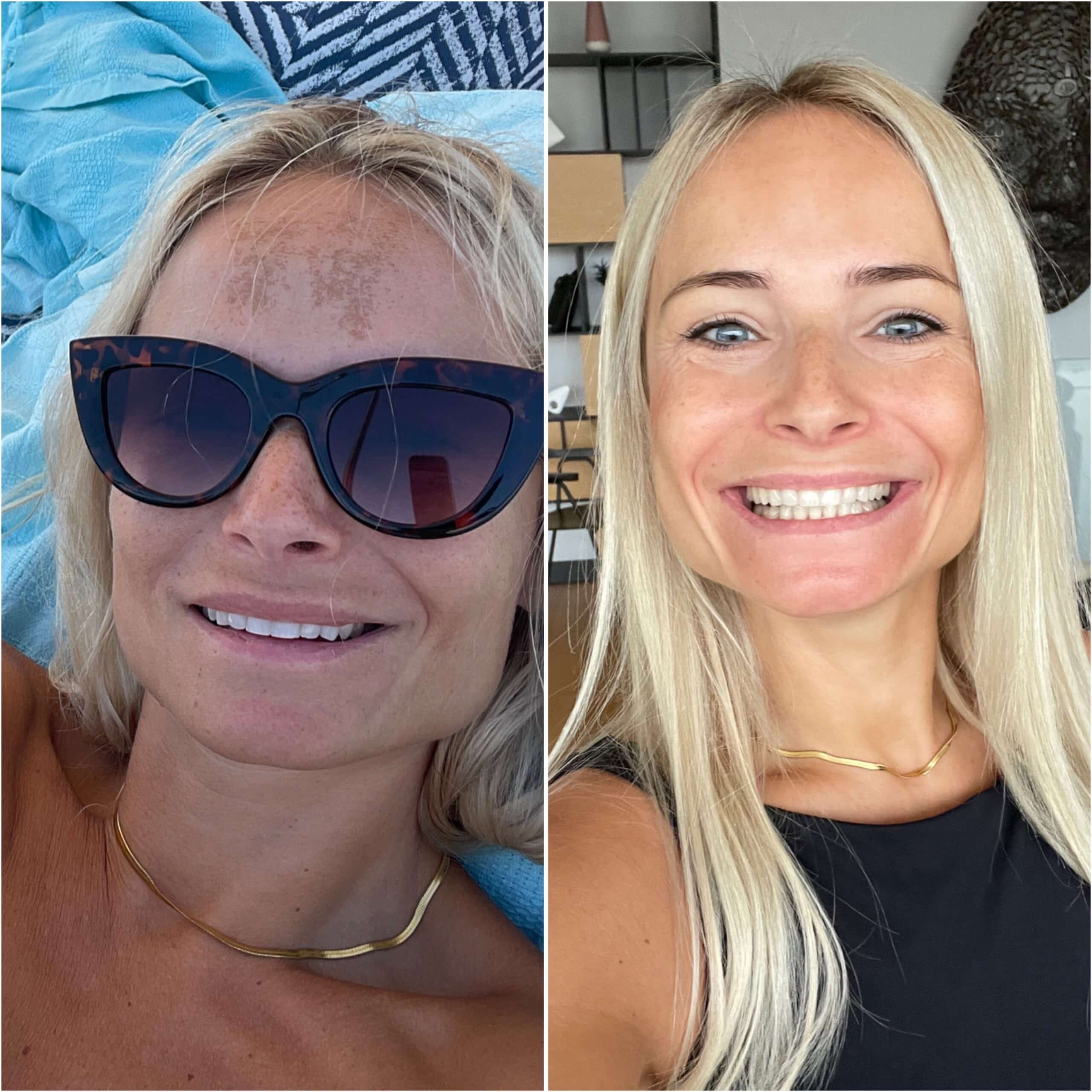 Obraz opcji produktu